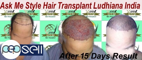 Ask Me Style Hair Transplant Ludhiana,Punjab  0 