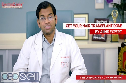 Hair Transplant Result Before and After at DERMACLINIX