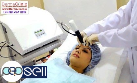 Laser Hair Removal-New Technique to Get Rid of Unwanted Hair Permanently 0 