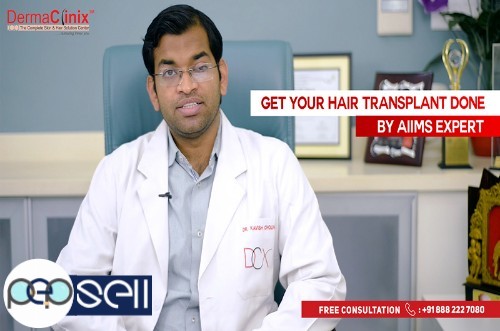 Questions to Ask About a Hair Transplantation Procedure 0 