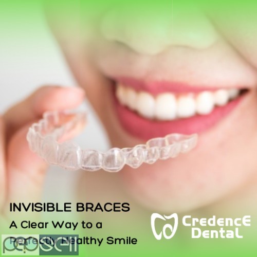Invisible brace specialists- credencedental clinic  0 