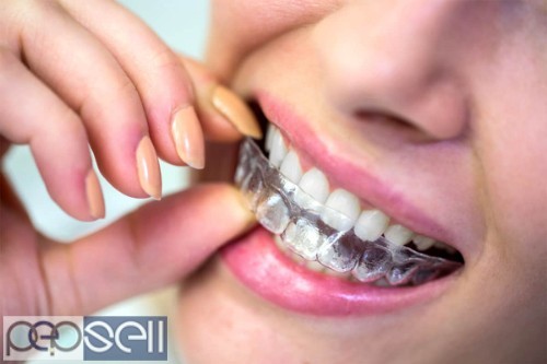 Best Invisible Braces Treatment in Bangalore | My Dentist Dental Clinic 0 